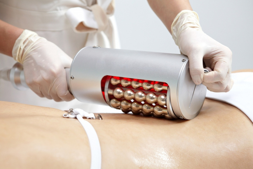 ENDO SHAPE Аппарат коррекции фигуры  фото 7