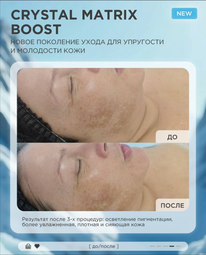 Биотайм Хрусталь матрикс буст (Biotime Crystal matrix boost), ампулы 5*3мл фото 5