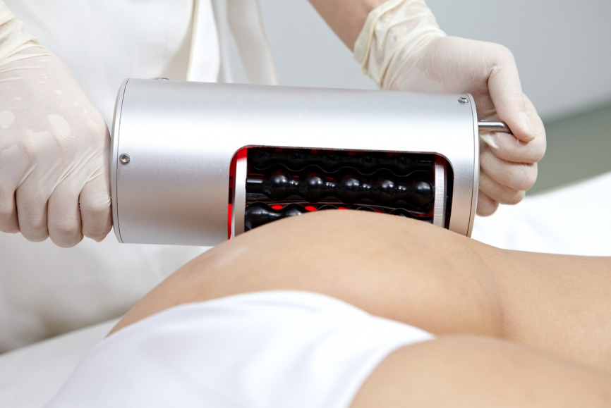 ENDO SHAPE Аппарат коррекции фигуры  фото 5