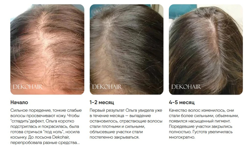 Средство для волос Декохаир\DEKOHAIR™, 60 мл  фото 3