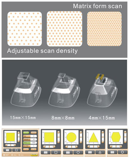 Renas (1550 нм) – фракционный эрбиевый лазер для омоложения и лечения рубцов фото 3